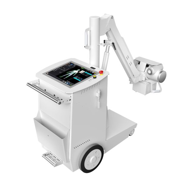 Mobile X-Ray